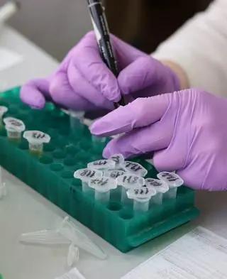 Onderzoek naar Sjögren